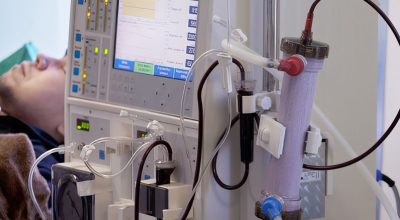 Estudo alerta para subdiagnóstico da doença renal crônica no Brasil