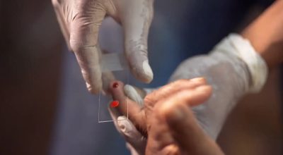 SUS começa a usar novo tratamento contra a malária em crianças