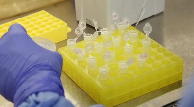 SP confirma segundo caso importado de sarampo