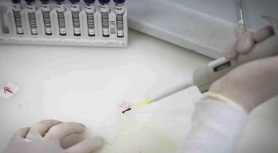 Paciente em SP com suspeita de ebola testa positivo para meningite
