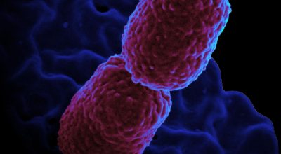 Hospital em Campinas restringe atendimento para conter superbactéria