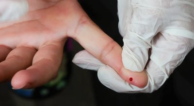SUS passa a oferecer teste rápido de dengue