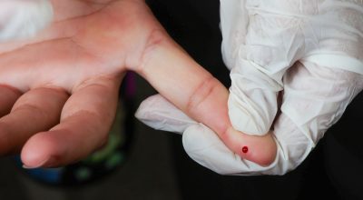 Brasil atinge meta de redução da transmissão vertical de hepatite B