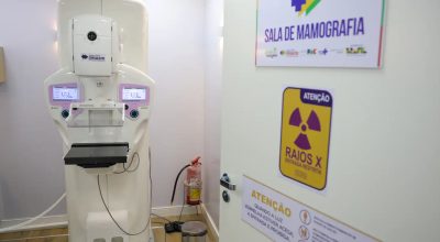 Quatro em cada dez mortes por câncer no Brasil são evitáveis