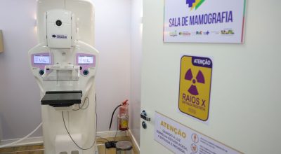 Cirurgias plásticas de mama no SUS crescem mais de 50% em dez anos