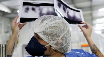 Brasil deve ter 781 mil novos casos de câncer por ano até 2028