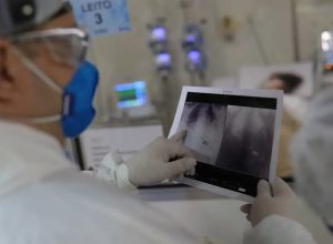 Broncopneumonia: entenda quadro que causou internação de Bolsonaro