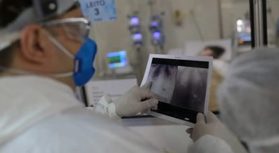 Broncopneumonia: entenda quadro que causou internação de Bolsonaro